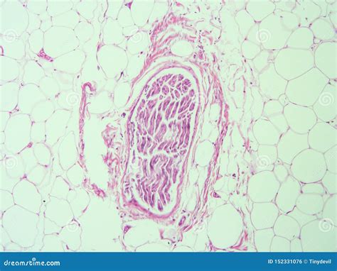 Histology Of Human Adipose Tissue Royalty-Free Stock Image ...