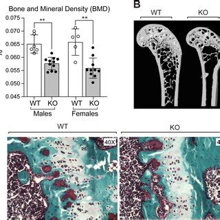 A Bone Mineral Density Bmd Assessed By Dualenergy Xray