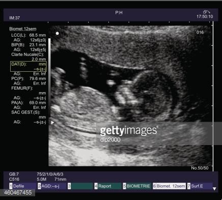 Ultrasound Fetus Stock Vector | Royalty-Free | FreeImages