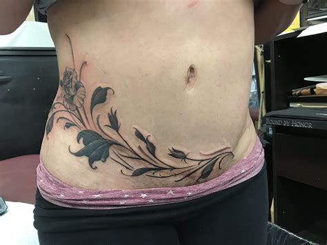 Tummy Tuck Tattoo