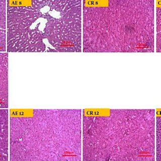 Images of different histological grades of fatty liver degeneration ...