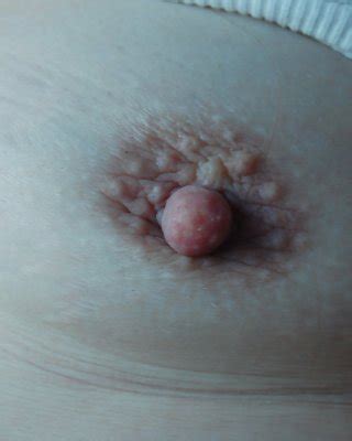 Crack Whore X Porn Pictures XXX Photos Sex Images 20315 PICTOA