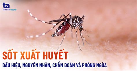 Tìm hiểu sâu về sốt xuất huyết triệu chứng gì và cách phòng ngừa