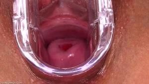 Watch Plateau Babe Cervix Fetish Porn SpankBang