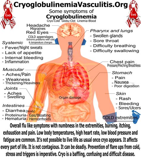 Cryoglobulinemia Vasculitis Organization Support