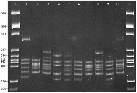 Polyacrylamide Gel Showing S Rdna Rflp Patterns Alui And Mboi L