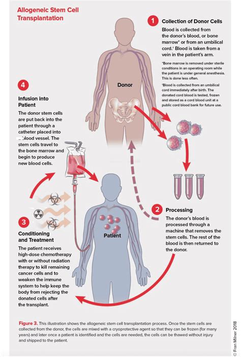 What Is Stem Cell Therapy