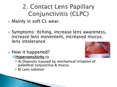 Complications Of Contact Lenses