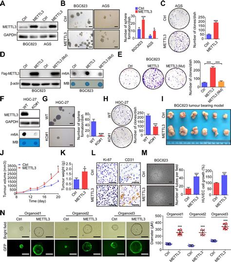 Mettl3 Mediated M6a Modification Of Hdgf Mrna Promotes Gastric Cancer Progression And Has