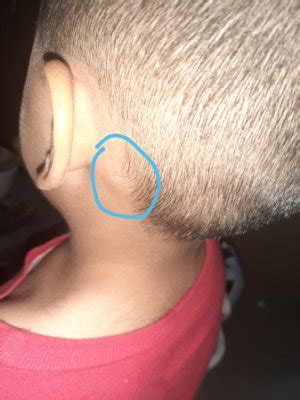 Los Alpes Micro Collar A Mi Hijo Le Duele La Oreja Ingenieria Etna Fiordo