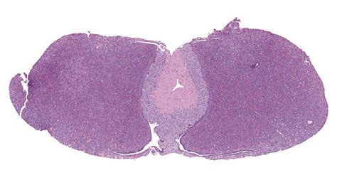 Figures Pathology Of The Mouse Pituitary Gland Toxicologic Pathology