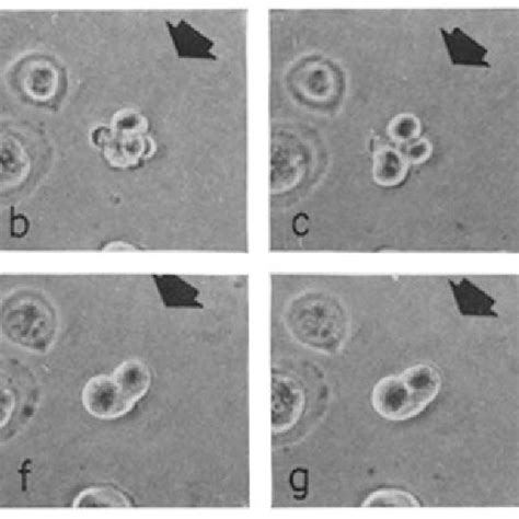 This Time Lapse Sequence Shows A Tripolar Division Frames B D In A