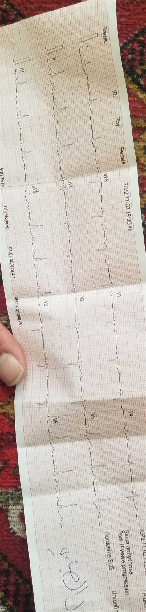 ECG INTERPRETATION, please | ResearchGate