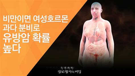 비만이면 여성호르몬 과다 분비로 유방암 확률 높다 2011 11 12 391회 방송 입체분석 3대 영양소의 진실 2