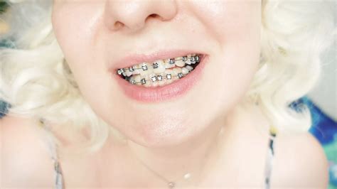 Braces Fetish Close Up Video Mukbang Close Up Porn Feat Arya Grander XHamster