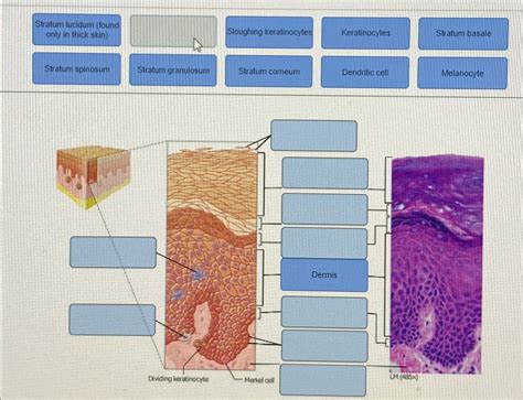 Solved Stratum lucidum (found only in thick skin)Stratum | Chegg.com