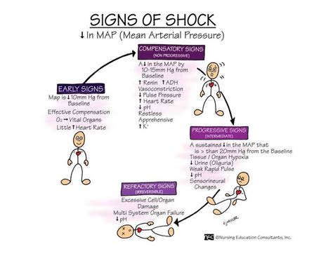 Signs of Shock | Nursing mnemonics, Nursing school survival, Nursing