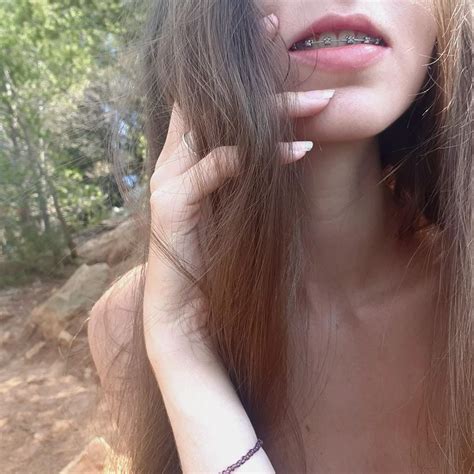 Nudes Braceface NUDE PICS ORG