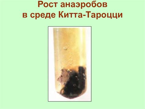 Анаэробная раневая инфекция (газовая гангрена)
