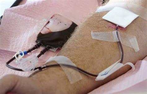 FDA Moves To Ease Rules For Blood Donations From Gay Men Sentinel