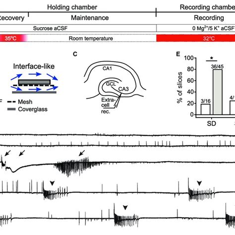 Spreading Depolarization Sd And Seizure Like Events Sles