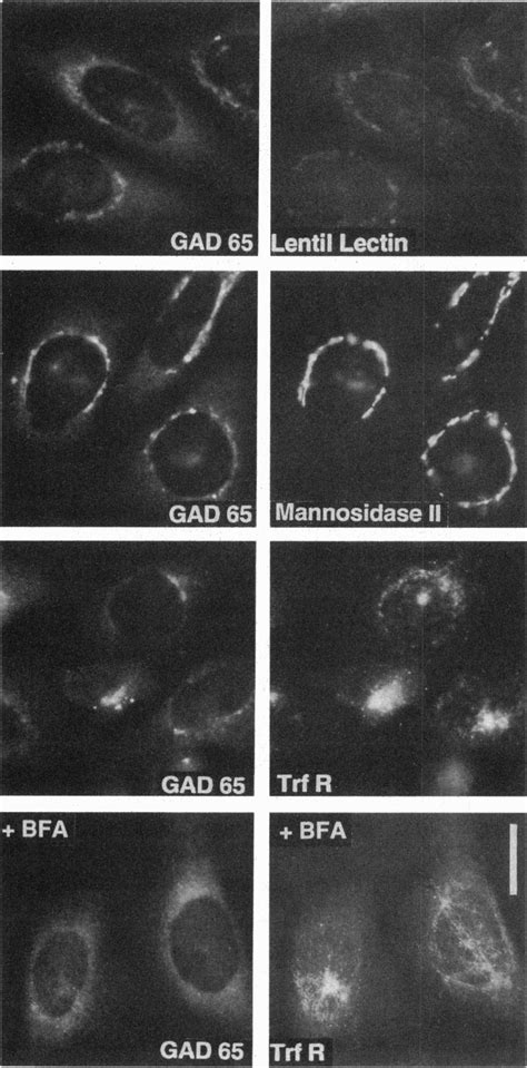 Double Immunofluorescence Micrographs Showing Comparison Of