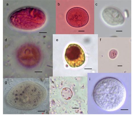 Entamoeba Nana Cyst