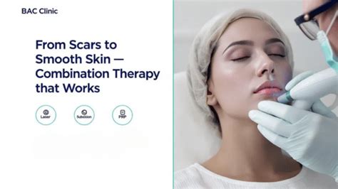 acne scar treatment