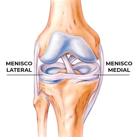 O Que Menisco Do Joelho - Lesão do Menisco em São Paulo | Dr. Guilherme Losso