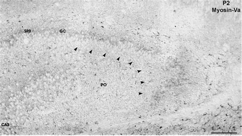 Coronal section (5 µm) of a rat hippocampus on postnatal day 2 (P2 ... 