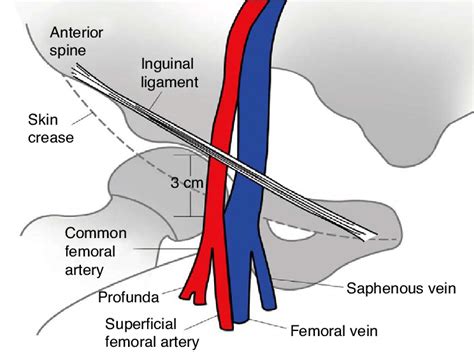 Femoral Artery And Vein Anatomy