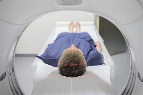 Ctcat Scan Faq Orthoindy Blog