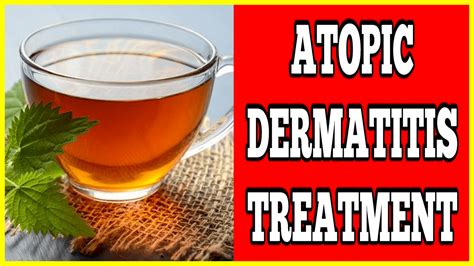 2 Powerful Atopic Dermatitis Treatments - Clinton Conley