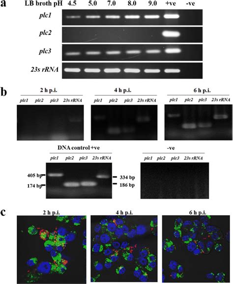 Reverse Transcription Rt Pcr Analysis Of B Pseudomallei Plc