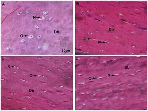 Osteocytes Morphology Stevenel S Van Gieson Staining Was Performed On