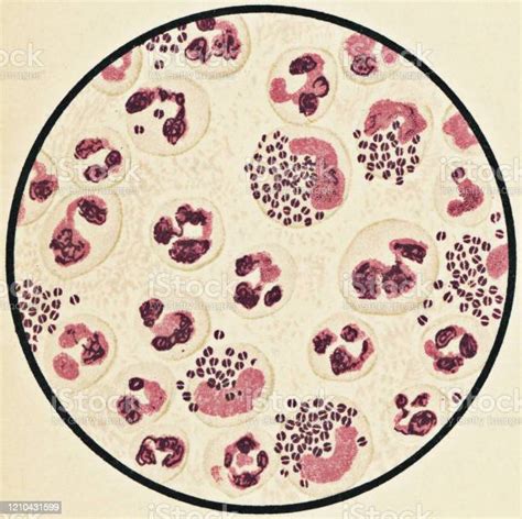 Merlins Micro World Neisseria Gonorrhoeae Morphology Cultural