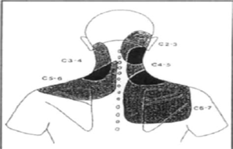 MMD Common MSK Disorders Of Cervicothoracic Spine EXAM2 Flashcards