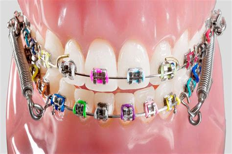 STANDARDBRACKETS Dr Nowroozi