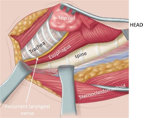 Chapter 12 – Trachea and Larynx | Anesthesia Key