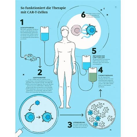 Erste Ambulante Car T Zell Therapie Medizinische Fakult T Lmu M Nchen