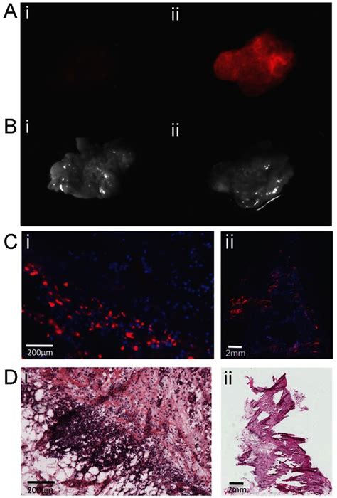 Uptake Of Ppf By Primary Human Omentum From High Grade Serous Ovarian