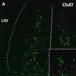 Anti Choline Acetyltransferase Antibody Serum Chemicon Sigma Aldrich