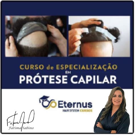 Protese Capilar Vale A Pena - ESPECIALIZACAO EM PROTESE CAPILAR VALE A PENA