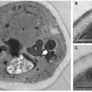 Changes In C Albicans Cell Ultrastructure After Min Incubation With