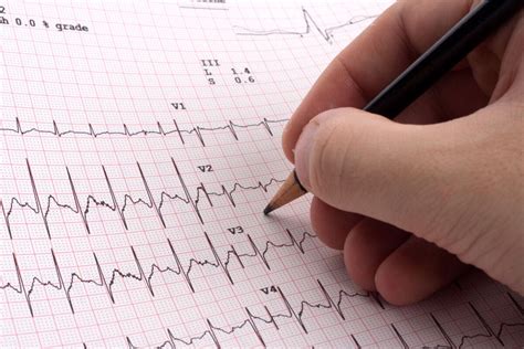 Decoding EKG Basics: A Comprehensive Guide for Aspiring Monitor Techs