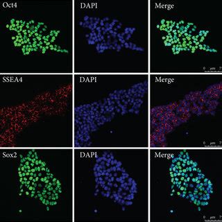 Characterization Of Hipscs And Hipsc Cms A Immunostaining Of Hipscs