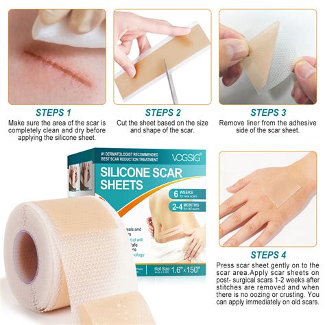 Scar Removal Silicone Tape For Hypertrophic Scars And Keloids 16 X 60