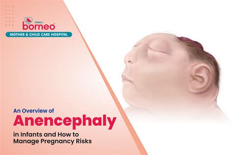 An Overview Of Anencephaly In Infants And How To Manage Pregnancy Risks By Borneohospital