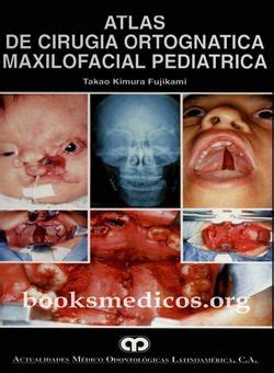 Atlas De Cirug A Ortogn Tica Maxilofacial Pedi Trica Descargar Gratis