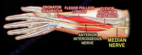 Dr. Nabil Ebraheim's Blogspot: Anterior Interosseous Nerve- The Benedictine and O.K. Sign